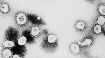 Imagem ilustrativa de vírus visto de microscópio - Getty Images