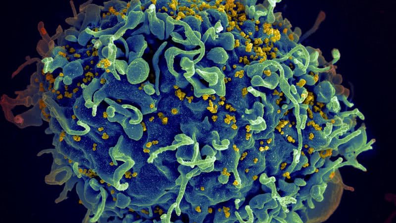 Representação do HIV, vírus da AIDS (em amarelo), infectando uma célula humana - Divulgação/ZEISS Microscopy/Flickr/Creative Commons