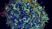 Representação do HIV, vírus da AIDS (em amarelo), infectando uma célula humana - Divulgação/ZEISS Microscopy/Flickr/Creative Commons