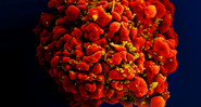 Célula infectada com o HIV - Divulgação/National Institute of Allergy and Infectious Diseases (NIAID)