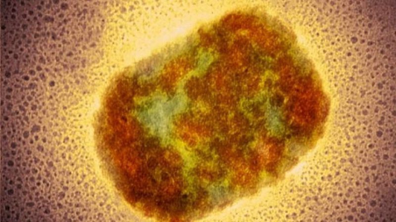 Vírus da varíola do macaco - Science Photo Library
