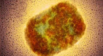 Vírus da varíola do macaco - Science Photo Library