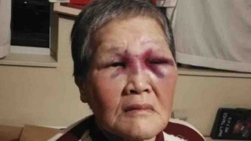 Xiao Zhen Xie após ser agredida - Divulgação