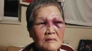 Xiao Zhen Xie após ser agredida - Divulgação