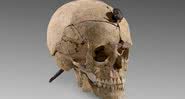 Crânio fixado com um prego - Divulgação/ Museu Arqueológico Nacional