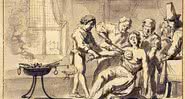 Representação de uma mastectomia no século 17 - divulg.