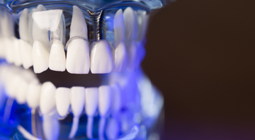 Arcada dentaria  - Shutterstock Images