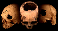 Crânios incas que foram analisados durante o estudo - Reprodução / Universidade de Miami