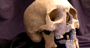 O crânio mostra a mandíbula golpeada do soldado francês. - Wiley Publishing