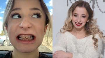 Fotos mostrando o antes e o depois de implante nos dentes de Mihaley Grace - Reprodução/TikTok @mihaley.olivia.grace