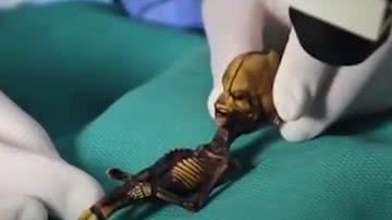 Imagem da 'múmia alienígena' sendo examinada por especialistas - Reprodução/Vídeo