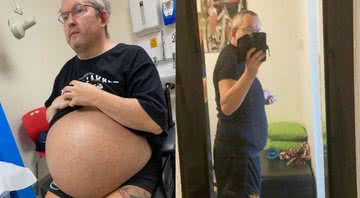 Fotografias do homem antes e depois da operação que salvou sua vida - Divulgação/ Warren Higgs/ Arquivo Pessoal