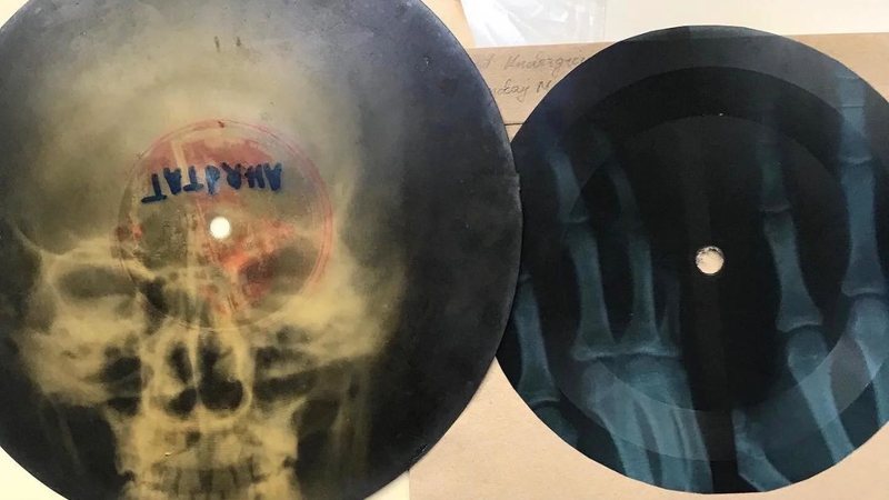 Chapas de raio-X usadas como discos musicais - Divulgação / Reddit / robxburninator