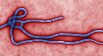 O vírus da Ebola - Wikimedia Commons