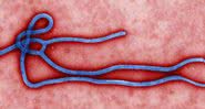 O vírus da Ebola - Wikimedia Commons