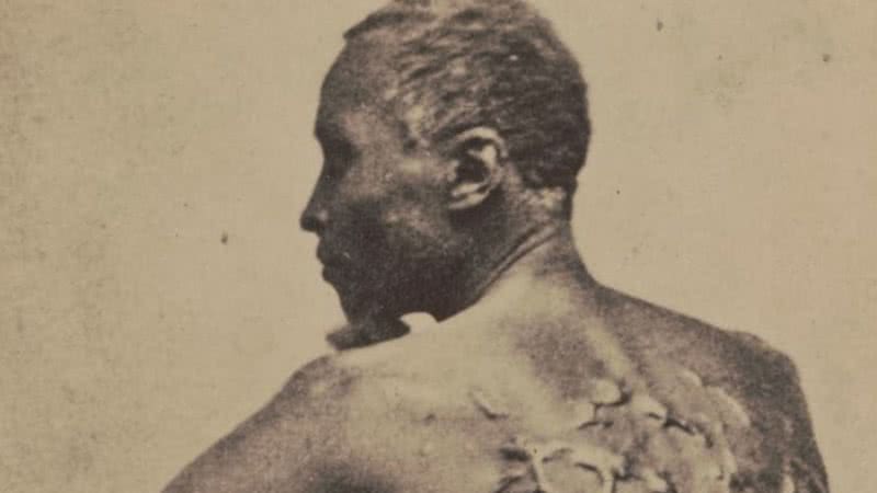 O escravo Peter mostrando as cicatrizes em suas costas - Library of Congress