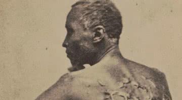 O escravo Peter mostrando as cicatrizes em suas costas - Library of Congress