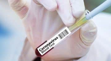 Imagem ilustrativa de um teste de sangue para detectar o coronavírus - Pixabay