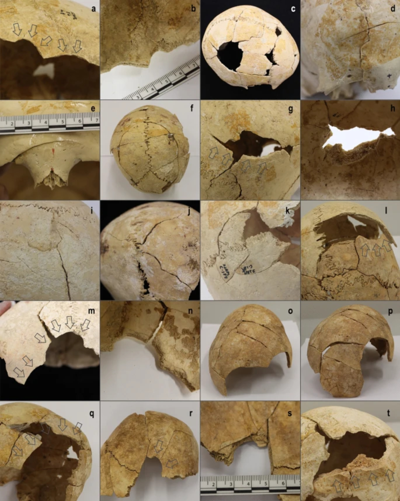 Imagens de crânios e outros ossos encontrados na Espanha