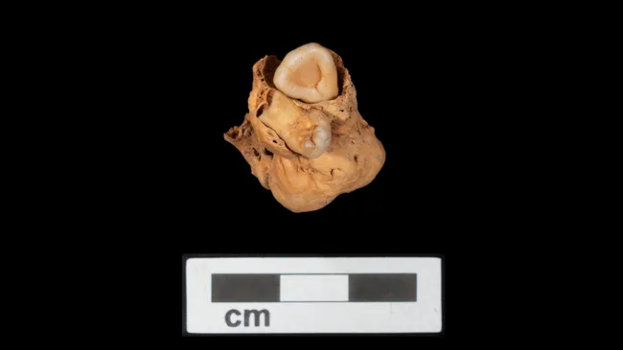 Teratoma descoberto recentemente em Amarna, no Egito