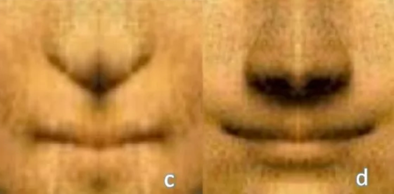 O lado esquerdo e o lado direito do sorriso da 'Mona Lisa', respectivamente, espelhado